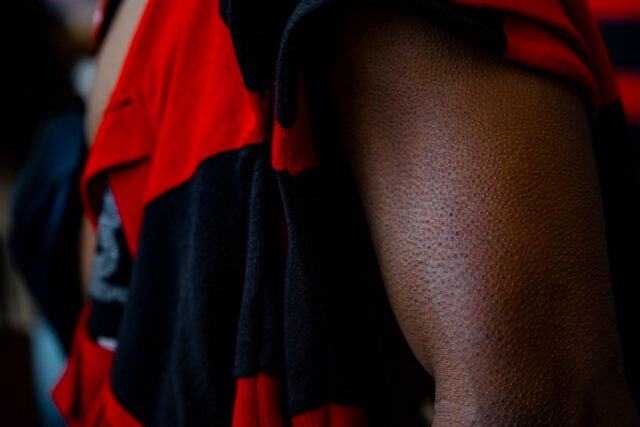 67_FOTO_VitorMelo Close no braço de um torcedor de pele negra. Ele tem uma camisa vermelho e preta pendurada no corpo e nota-se sua pele arrepiada.